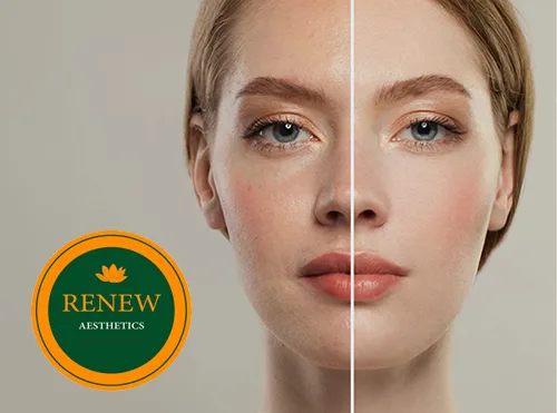 Portfolio Renew Cosmetic Surgeries